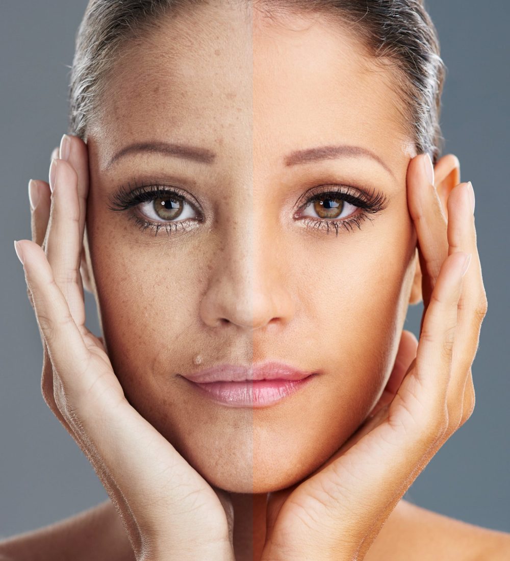 Skin regeneration Skin regeneration